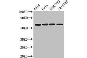 Western Blot Positive WB detected in: A549 whole cell lysate, Hela whole cell lysate, NIH/3T3 whole cell lysate, SH-SY5Y whole cell lysate All lanes: IRF5 antibody at 3 μg/mL Secondary Goat polyclonal to rabbit IgG at 1/50000 dilution Predicted band size: 57, 58, 55, 48, 18 kDa Observed band size: 57 kDa