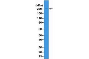 Western blot of A431 cell lysate using recombinant ACC antibody at 1:1000. (Recombinant Acetyl-CoA Carboxylase 抗体)