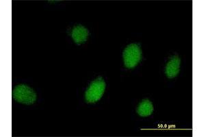 Immunofluorescence of purified MaxPab antibody to PEPP-2 on HeLa cell. (RHOXF2 抗体  (AA 1-288))