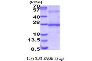SDS-PAGE (SDS) image for Interleukin 29 (IL29) (AA 20-200) protein (His tag) (ABIN5854065)