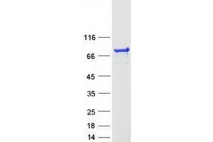 Validation with Western Blot