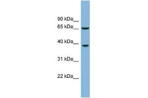WB Suggested Anti-RLBP1L1 Antibody Titration: 0. (Clavesin 1 抗体  (Middle Region))