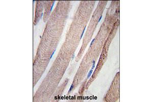 Formalin-fixed and paraffin-embedded human skeletal muscle tissue reacted with PHPT1 polyclonal antibody  , which was peroxidase-conjugated to the secondary antibody, followed by DAB staining. (PHPT1 抗体  (N-Term))