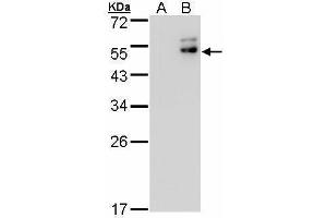 WB Image Western Blot analysis of DPF2 expression in transfected 293T cell line by DPF2 polyclonal antibody. (DPF2 抗体  (Center))