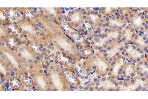 Immunohistochemistry (IHC) image for anti-Fatty Acid Desaturase 2 (FADS2) (AA 1-130) antibody (ABIN7436027)