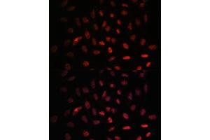 Immunofluorescence analysis of U-2 OS cells using NXT2 antibody (ABIN6133260, ABIN6144977, ABIN6144978 and ABIN6217951) at dilution of 1:100. (NXT2 抗体  (AA 110-180))