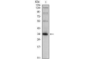 Western Blot showing SYP antibody used against rat brain tissue lysate. (Synaptophysin 抗体)