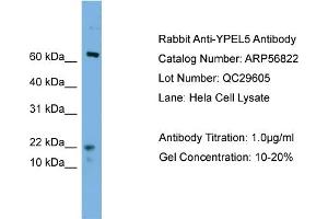 WB Suggested Anti-YPEL5  Antibody Titration: 0. (YPEL5 抗体  (N-Term))