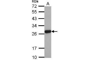 WB Image Sample (30 ug of whole cell lysate) A: PC-3 12% SDS PAGE antibody diluted at 1:2000 (Elastase 3A 抗体)