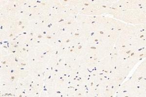 Immunohistochemistry analysis of paraffin-embedded mouse heart using,PPM1G (ABIN7075287) at dilution of 1: 3000 (PPM1G 抗体)