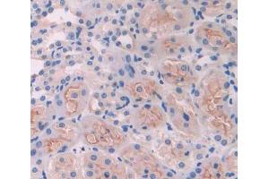 Immunohistochemistry (IHC) image for anti-ATP-Binding Cassette, Sub-Family B (MDR/TAP), Member 8 (ABCB8) (AA 468-717) antibody (ABIN5013188)