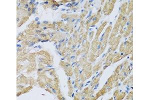 Immunohistochemistry (Paraffin-embedded Sections) (IHC (p)) image for anti-Corticotropin Releasing Hormone Binding Protein (CRHBP) antibody (ABIN7262433)