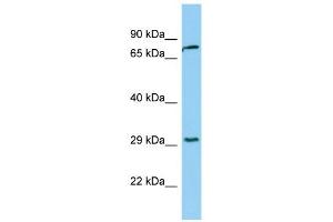 WB Suggested Anti-KLK2 Antibody Titration:  0. (Kallikrein 2 抗体  (Middle Region))