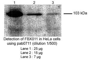Image no. 1 for anti-F-Box Protein 11 (FBXO11) (Internal Region) antibody (ABIN559708) (FBXO11 抗体  (Internal Region))