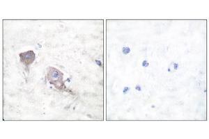 Immunohistochemistry (IHC) image for anti-Synaptosomal-Associated Protein, 25kDa (SNAP25) (C-Term) antibody (ABIN1848775) (SNAP25 抗体  (C-Term))