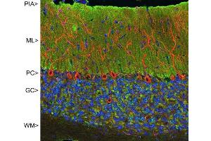 Confocal image of adult rat cerebellar cortex stained with MCA- 2D11 (green), chicken polyclonal antibody to MAP2 CPCA-MAP2 (red) and DNA (blue). (VSNL1 抗体)