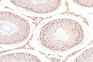 Immunohistochemistry analysis of paraffin-embedded rat testis using,TADA2B (ABIN7075957) at dilution of 1: 3200