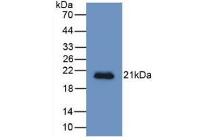 Detection of Recombinant HJV, Human using Monoclonal Antibody to Hemojuvelin (HJV)