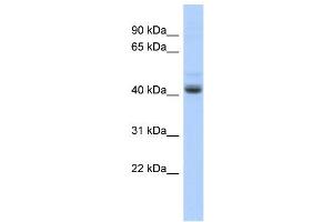 WB Suggested Anti-PKNOX1 Antibody Titration:  0. (PKNOX1 抗体  (Middle Region))