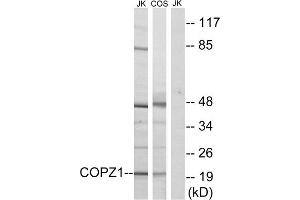 Western blot analysis of extracts from Jurkat cells and COS cells, using COPZ1 antibody. (COPZ1 抗体  (N-Term))