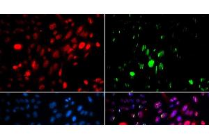 Immunofluorescence analysis of U2OS cells using Phospho-ABL1(Y204) Polyclonal Antibody (ABL1 抗体  (pTyr204))