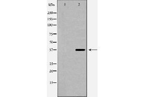 Western blot analysis of extracts of HepG2 , using CFHR1 antibody. (CFHR1 抗体  (C-Term))