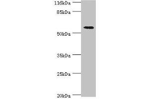 Western blot All lanes: ACBD5 antibody at 2 μg/mL + Hela whole cell lysate Secondary Goat polyclonal to rabbit IgG at 1/10000 dilution Predicted band size: 61, 55, 59, 47 kDa Observed band size: 61 kDa (ACBD5 抗体  (AA 1-461))