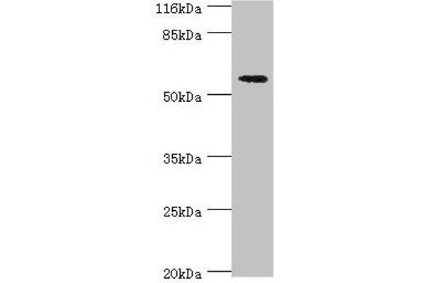 ACBD5 anticorps  (AA 1-461)