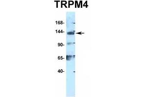 Western Blotting (WB) image for anti-Transient Receptor Potential Cation Channel, Subfamily M, Member 4 (TRPM4) (N-Term) antibody (ABIN2776221)