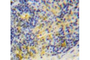 Used in DAB staining on fromalin fixed paraffin-embedded Spleen tissue (TRAF1 抗体  (AA 169-392))