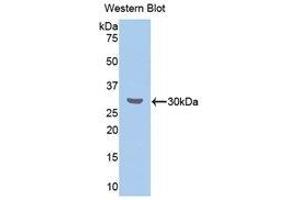 Western Blotting (WB) image for anti-Cholesteryl Ester Transfer Protein (CETP) (AA 232-487) antibody (ABIN1858369) (CETP 抗体  (AA 232-487))