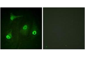 Immunofluorescence analysis of HeLa cells, using NF-kappaB p65 (Acetyl-Lys310) Antibody. (NF-kB p65 抗体  (acLys310))