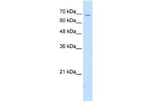 WB Suggested Anti-IL18RAP Antibody Titration:  2. (IL18RAP 抗体  (N-Term))