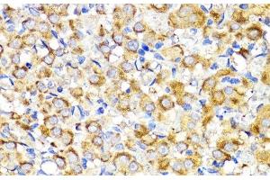 Immunohistochemistry (Paraffin-embedded Sections) (IHC (p)) image for anti-Bone Morphogenetic Protein Receptor, Type IB (BMPR1B) antibody (ABIN7260047)
