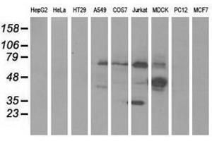 Image no. 1 for anti-Kelch-Like 2, Mayven (KLHL2) (AA 1-100), (AA 494-593) antibody (ABIN1490547) (KLHL2 抗体  (AA 1-100, AA 494-593))