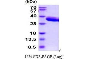 SDS-PAGE (SDS) image for Protease, serine, 22 (PRSS22) (AA 33-307) protein (His tag) (ABIN5854623) (PRSS22 Protein (AA 33-307) (His tag))