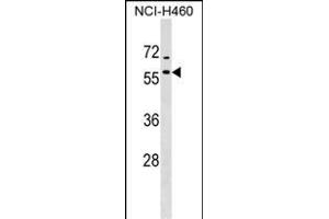 DNAJA4 Antibody (C-term) (ABIN1536998 and ABIN2849123) western blot analysis in NCI- cell line lysates (35 μg/lane). (DNAJA4 抗体  (C-Term))