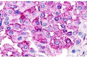 Image no. 2 for anti-G Protein-Coupled Receptor 21 (GPR21) (Cytoplasmic Domain) antibody (ABIN1048777) (GPR21 抗体  (Cytoplasmic Domain))