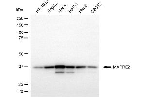Western blotting analysis using MAPRE2 antibody (ABIN7799411). (MAPRE2 抗体)