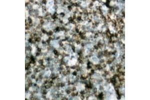 Immunohistochemistry (IHC) image for anti-B-Cell CLL/lymphoma 2 (BCL2) (Center) antibody (ABIN7301506)