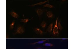 Immunofluorescence analysis of U-2 OS cells using VMP1 Polyclonal Antibody at dilution of 1:100 (40x lens). (VMP1 抗体)