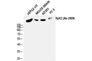 Western Blot analysis of HepG2-UV, Mouse brain, AD293T, PC-3 using RYR2 Polyclonal Antibody at dilution of 1:2000. (RYR2 抗体)