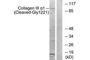 Western blot analysis of extracts from A549 cells, treated with etoposide 25uM 24h, using Collagen III alpha1 (Cleaved-Gly1221) Antibody. (COL3A1 抗体  (Cleaved-Gly1221))