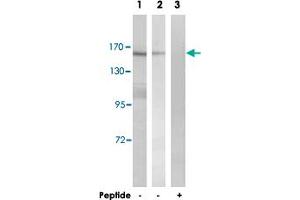 Western blot analysis of extracts from K-562 cells (Lane 1 and lane 3) and HT-29 cells (Lane 2), using MLH3 polyclonal antibody . (MLH3 抗体)