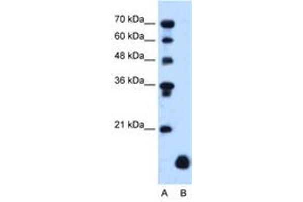 PLP2 抗体  (C-Term)