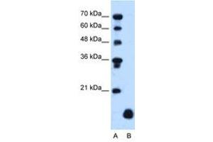 Image no. 1 for anti-Proteolipid Protein 2 (PLP2) (C-Term) antibody (ABIN205077) (PLP2 抗体  (C-Term))