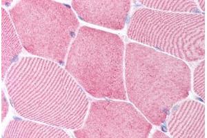 anti-Caspase 6, Apoptosis-Related Cysteine Peptidase (CASP6) (N-Term) antibody