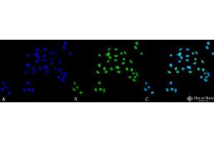 Immunocytochemistry/Immunofluorescence analysis using Rabbit Anti-ATG5 Polyclonal Antibody . (ATG5 抗体  (N-Term) (APC))