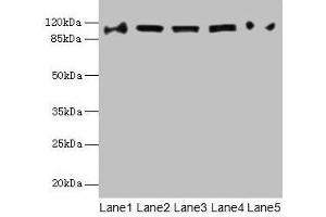 Western blot All lanes: COPB1 antibody at 1 μg/mL Lane 1: Hela whole cell lysate Lane 2: Jurkat whole cell lysate Lane 3: NIH/3T3 whole cell lysate Lane 4: Mouse liver tissue Lane 5: A549 whole cell lysate Secondary Goat polyclonal to rabbit IgG at 1/10000 dilution Predicted band size: 108 kDa Observed band size: 108 kDa (COPB1 抗体  (AA 2-200))