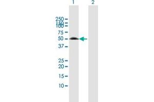 Western Blot analysis of XIAP expression in transfected 293T cell line by XIAP MaxPab polyclonal antibody. (XIAP 抗体  (AA 1-497))